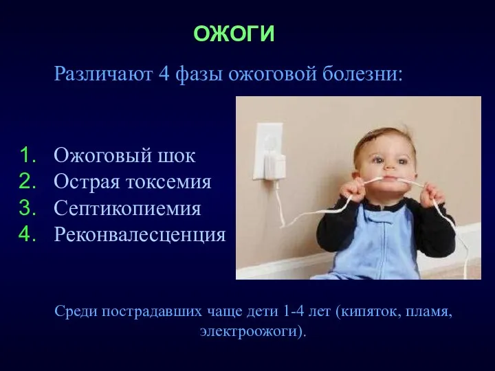 Ожоговый шок Острая токсемия Септикопиемия Реконвалесценция ОЖОГИ Среди пострадавших чаще дети 1-4 лет