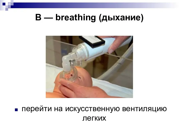 В — breathing (дыхание) перейти на искусственную вентиляцию легких