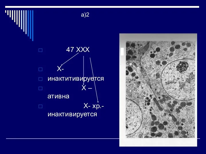 а)2 47 ХХХ Х- инактитивируется Х – ативна Х- хр.-инактивируется