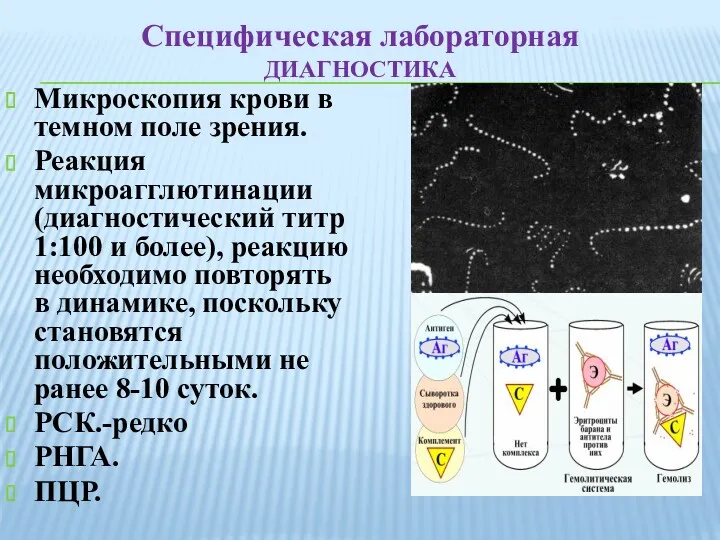 Микроскопия крови в темном поле зрения. Реакция микроагглютинации (диагностический титр