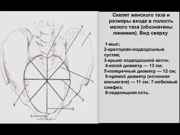 Скелет женского таза и размеры входа в полость малого таза (обозначены линиями). Вид