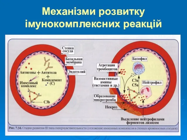 Механізми розвитку імунокомплексних реакцій