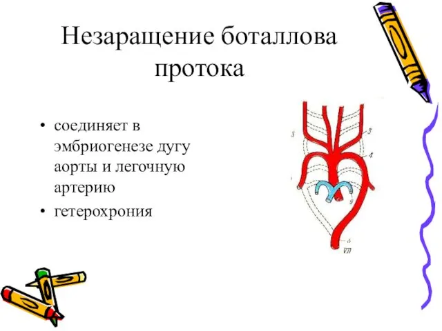 Незаращение боталлова протока соединяет в эмбриогенезе дугу аорты и легочную артерию гетерохрония