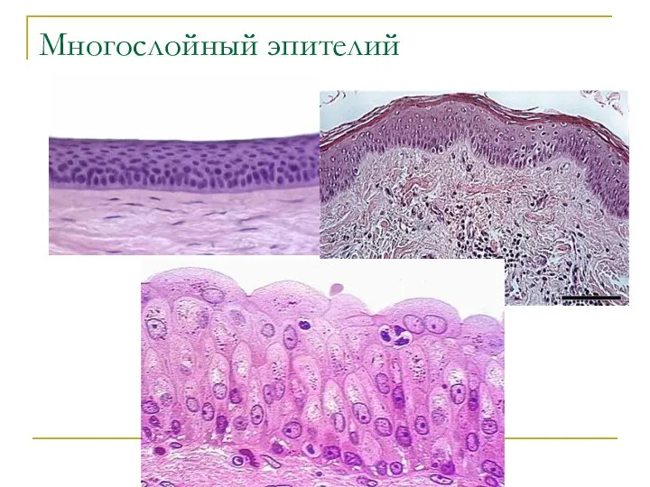 Многослойный эпителий