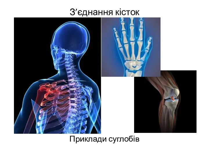 З’єднання кісток Приклади суглобів