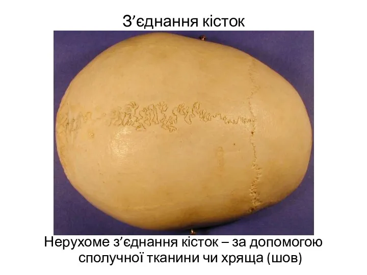З’єднання кісток Нерухоме з’єднання кісток – за допомогою сполучної тканини чи хряща (шов)