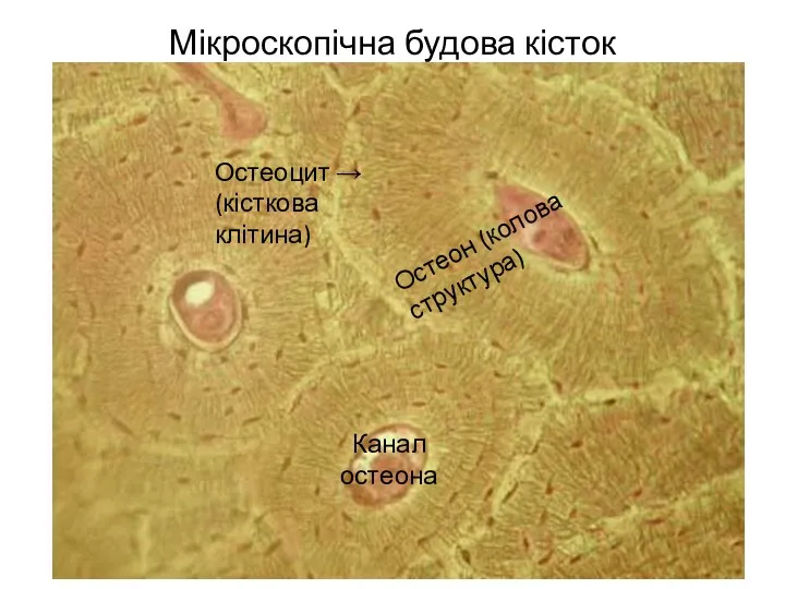 Мікроскопічна будова кісток Остеоцит → (кісткова клітина) Остеон (колова структура) Канал остеона