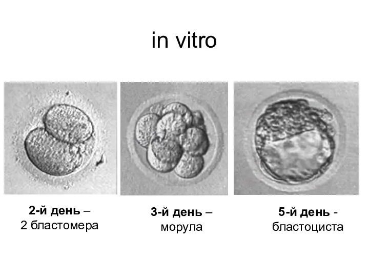 in vitro 2-й день – 2 бластомера 3-й день – морула 5-й день - бластоциста