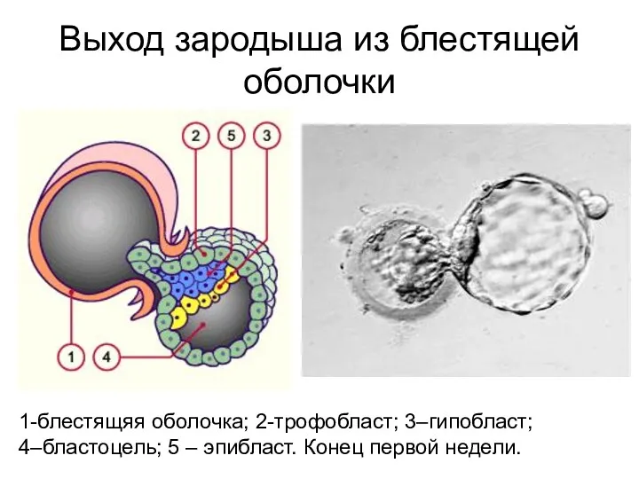 Выход зародыша из блестящей оболочки 1-блестящяя оболочка; 2-трофобласт; 3–гипобласт; 4–бластоцель; 5 – эпибласт. Конец первой недели.