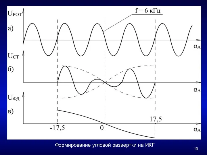 Формирование угловой развертки на ИКГ