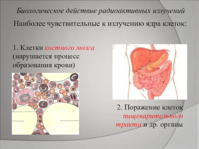 Наиболее чувствительные к излучению ядра клеток: 1. Клетки костного мозга