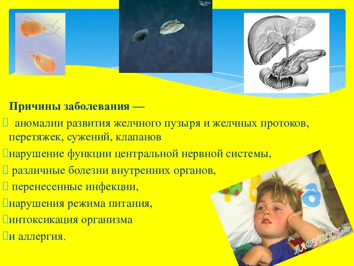 Причины заболевания — аномалии развития желчного пузыря и желчных протоков, перетяжек, сужений, клапанов