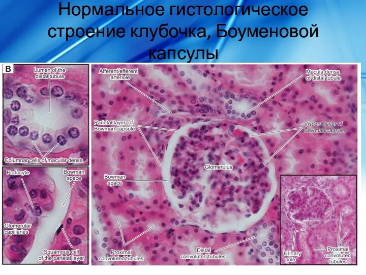 Нормальное гистологическое строение клубочка, Боуменовой капсулы