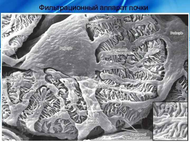 Фильтрационный аппарат почки