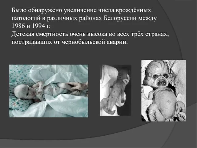 Было обнаружено увеличение числа врождённых патологий в различных районах Белоруссии
