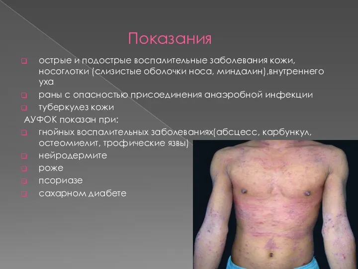 Показания острые и подострые воспалительные заболевания кожи, носоглотки (слизистые оболочки