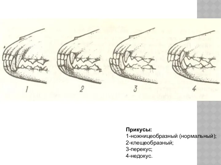 Прикусы: 1-ножницеобразный (нормальный); 2-клещеобразный; 3-перекус; 4-недокус.