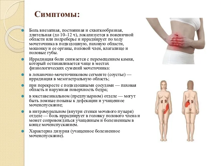 Симптомы: Боль внезапная, постоянная и схваткообразная, длительная (до 10–12 ч), локализуется в поясничной