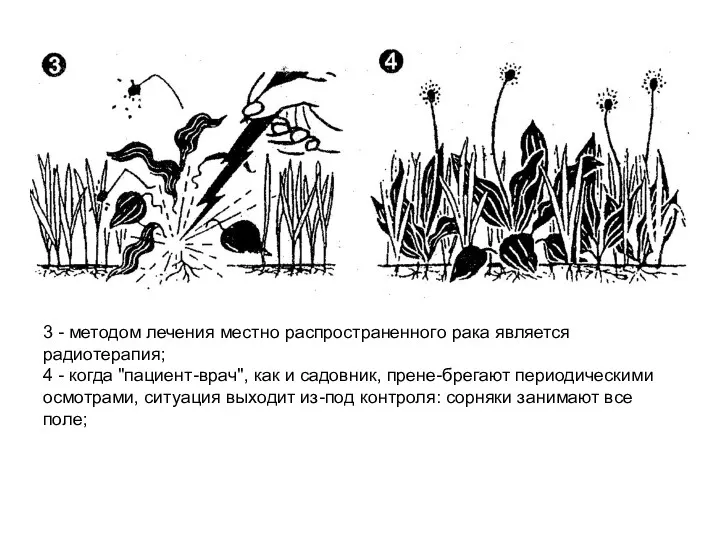 3 - методом лечения местно распространенного рака является радиотерапия; 4