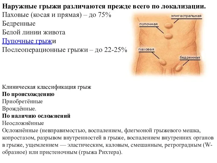 Наружные грыжи различаются прежде всего по локализации. Паховые (косая и