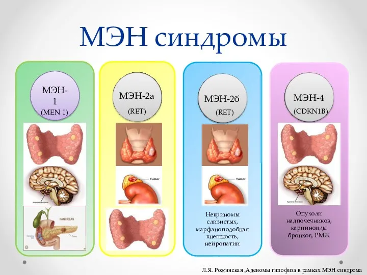 МЭН синдромы Невриномы слизистых, марфаноподобная внешность, нейропатии МЭН-1 МЭН-2а МЭН-2б