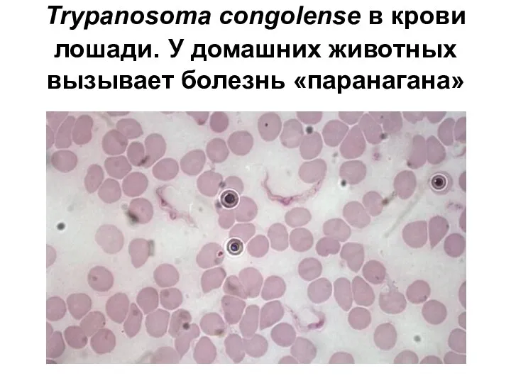 Trypanosoma congolense в крови лошади. У домашних животных вызывает болезнь «паранагана»