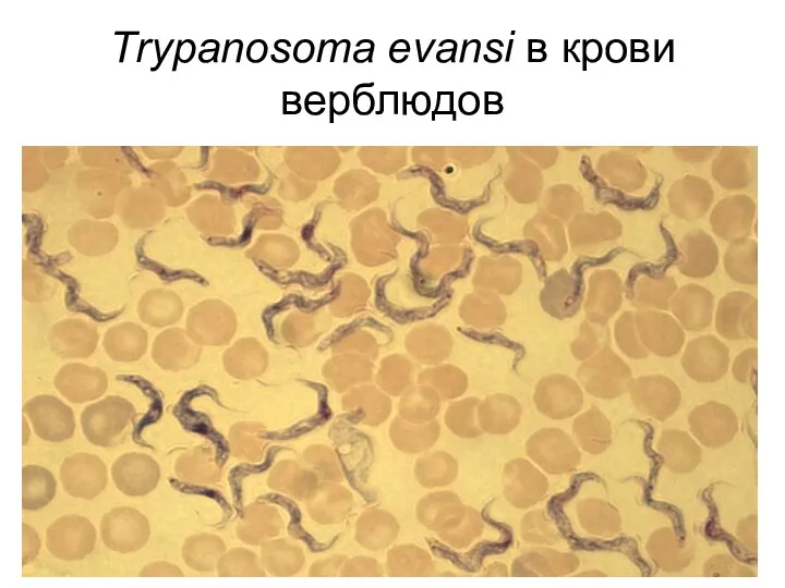 Тrypanosoma evansi в крови верблюдов