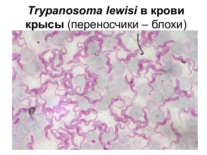 Trypanosoma lewisi в крови крысы (переносчики – блохи)