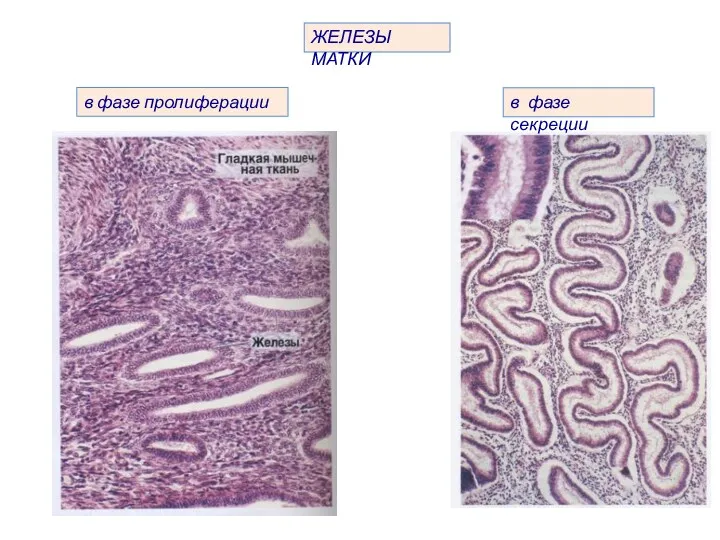 ЖЕЛЕЗЫ МАТКИ в фазе секреции в фазе пролиферации