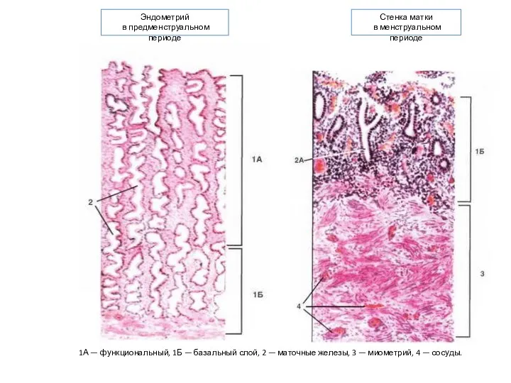 1А — функциональный, 1Б — базальный слой, 2 — маточные железы, 3 —