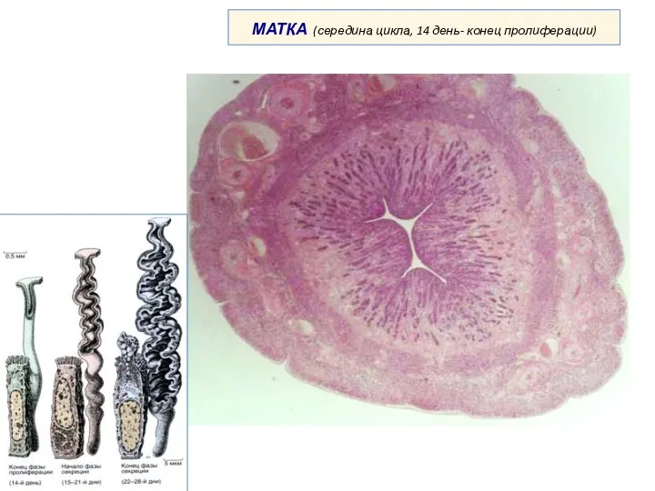 МАТКА (середина цикла, 14 день- конец пролиферации)