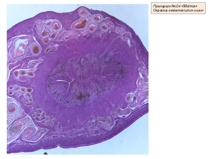 Препарат №154 «Матка» Окраска: гематоксилин-эозин