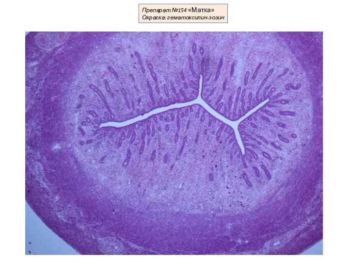 Препарат №154 «Матка» Окраска: гематоксилин-эозин