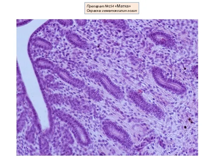 Препарат №154 «Матка» Окраска: гематоксилин-эозин
