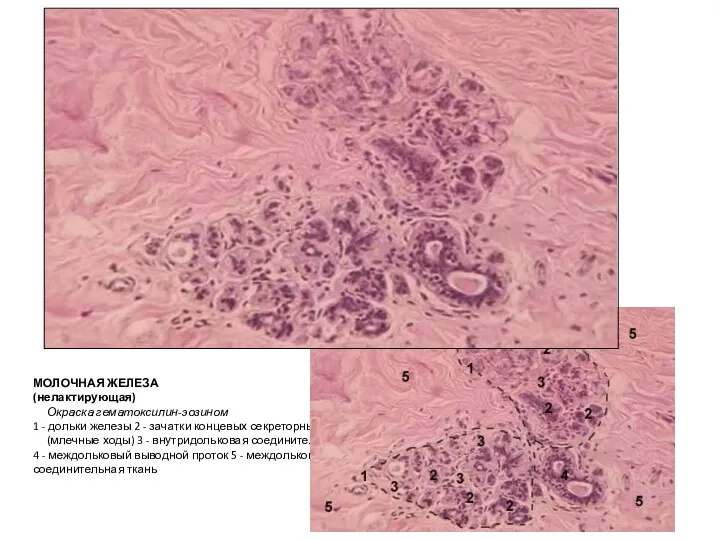 МОЛОЧНАЯ ЖЕЛЕЗА (нелактирующая) Окраска гематоксилин-эозином 1 - дольки железы 2 - зачатки концевых