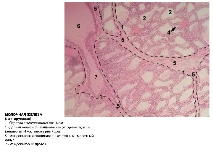 МОЛОЧНАЯ ЖЕЛЕЗА (лактирующая) Окраска гематоксилин-эозином 1 - дольки железы 2 - концевые секреторные