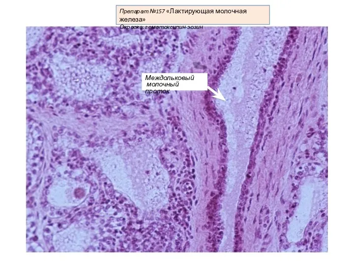 Препарат №157 «Лактирующая молочная железа» Окраска: гематоксилин-эозин Междольковый молочный проток