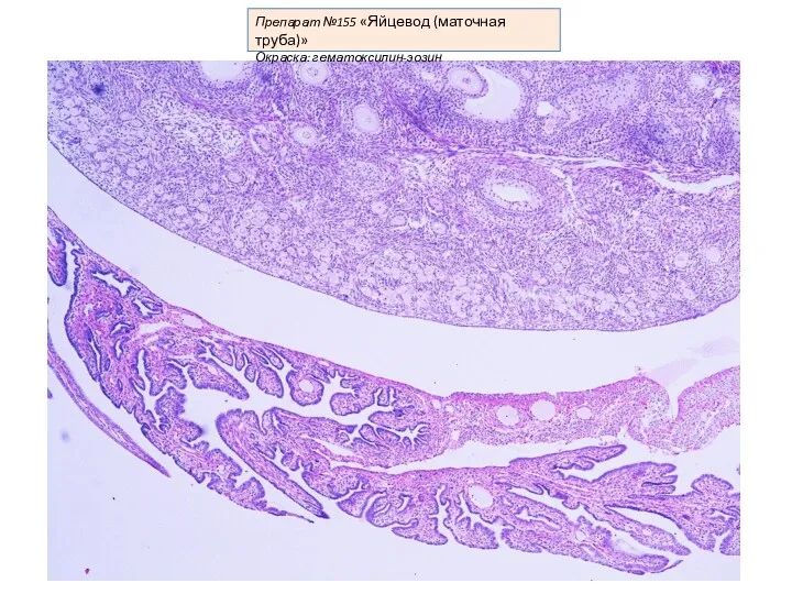 Препарат №155 «Яйцевод (маточная труба)» Окраска: гематоксилин-эозин