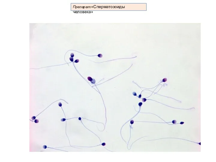 Препарат «Сперматозоиды человека»