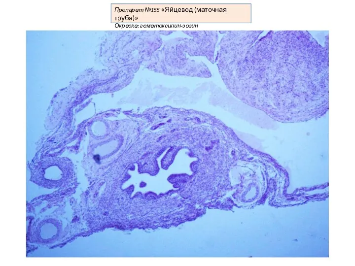 Препарат №155 «Яйцевод (маточная труба)» Окраска: гематоксилин-эозин