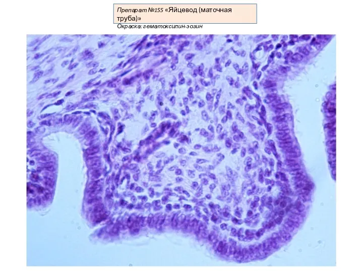 Препарат №155 «Яйцевод (маточная труба)» Окраска: гематоксилин-эозин