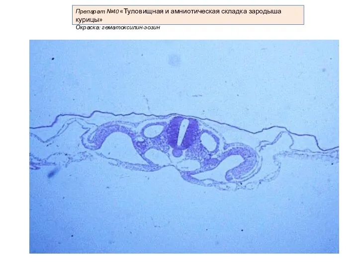 Препарат №40 «Туловищная и амниотическая складка зародыша курицы» Окраска: гематоксилин-эозин