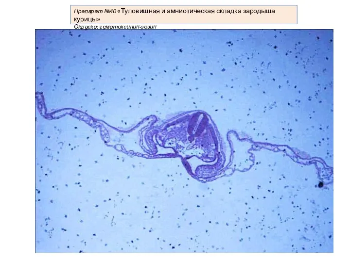Препарат №40 «Туловищная и амниотическая складка зародыша курицы» Окраска: гематоксилин-эозин