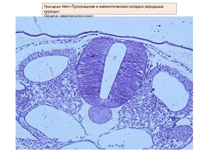Препарат №40 «Туловищная и амниотическая складка зародыша курицы» Окраска: гематоксилин-эозин