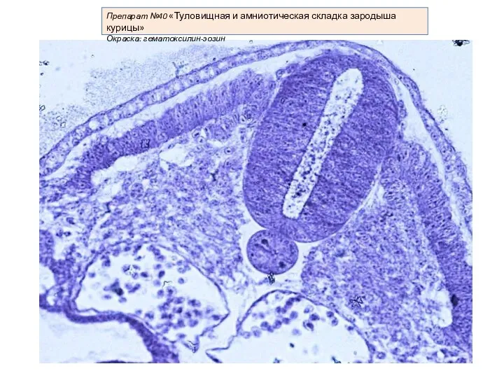 Препарат №40 «Туловищная и амниотическая складка зародыша курицы» Окраска: гематоксилин-эозин