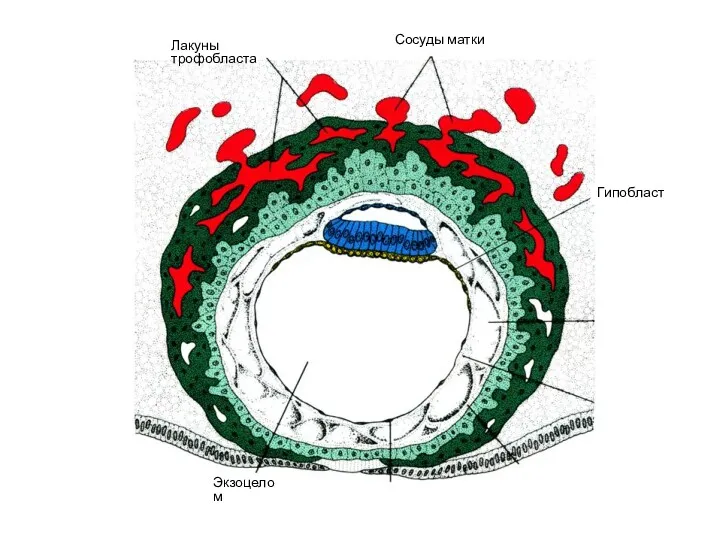 Сосуды матки Лакуны трофобласта Гипобласт Экзоцелом
