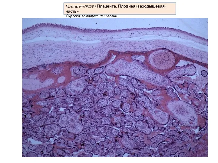 Препарат №158 «Плацента. Плодная (зародышевая) часть» Окраска: гематоксилин-эозин