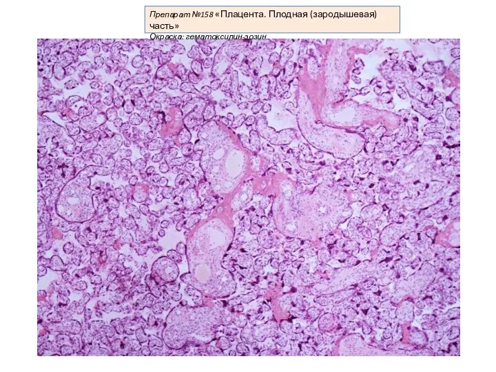 Препарат №158 «Плацента. Плодная (зародышевая) часть» Окраска: гематоксилин-эозин