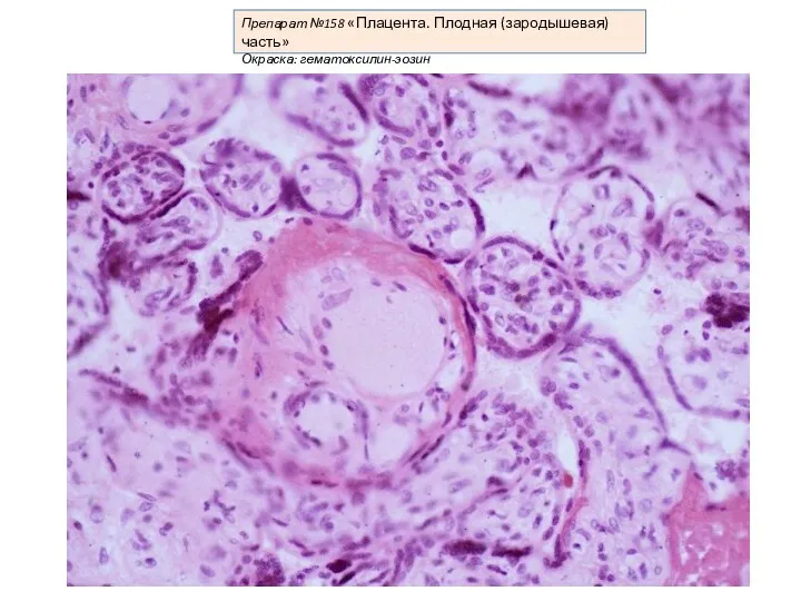 Препарат №158 «Плацента. Плодная (зародышевая) часть» Окраска: гематоксилин-эозин