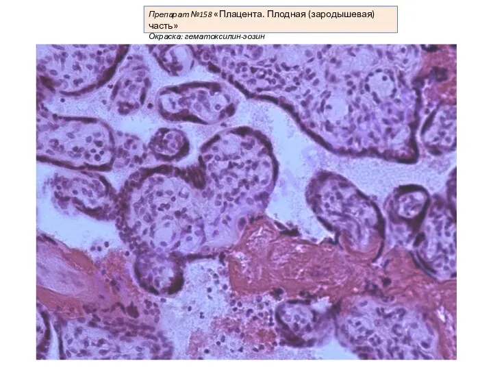 Препарат №158 «Плацента. Плодная (зародышевая) часть» Окраска: гематоксилин-эозин